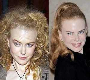 Nicole Kidman | Παραδέχεται τα botox (επιτέλους)