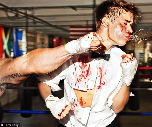 Justin Bieber | Γεμάτος αίματα μετά από μπουνιές!