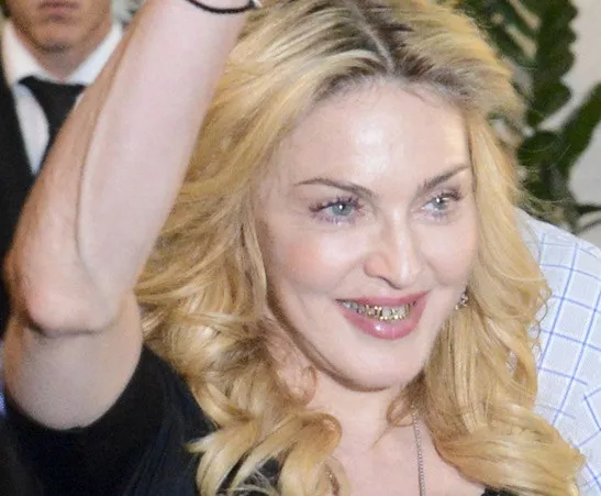 Madonna | Κυκλοφορεί με χρυσό χαμόγελο! [photo] 
