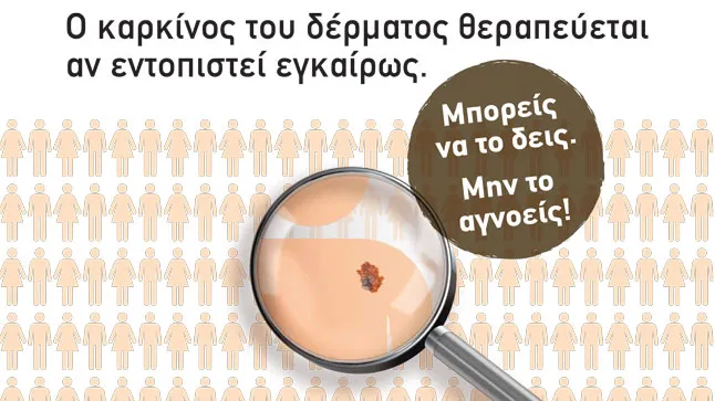 Ελληνική Εβδομάδα κατά του Καρκίνου του Δέρματος