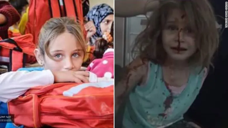 Συρία: Τραυματισμένο κοριτσάκι ψάχνει τον πατέρα της (βίντεο)