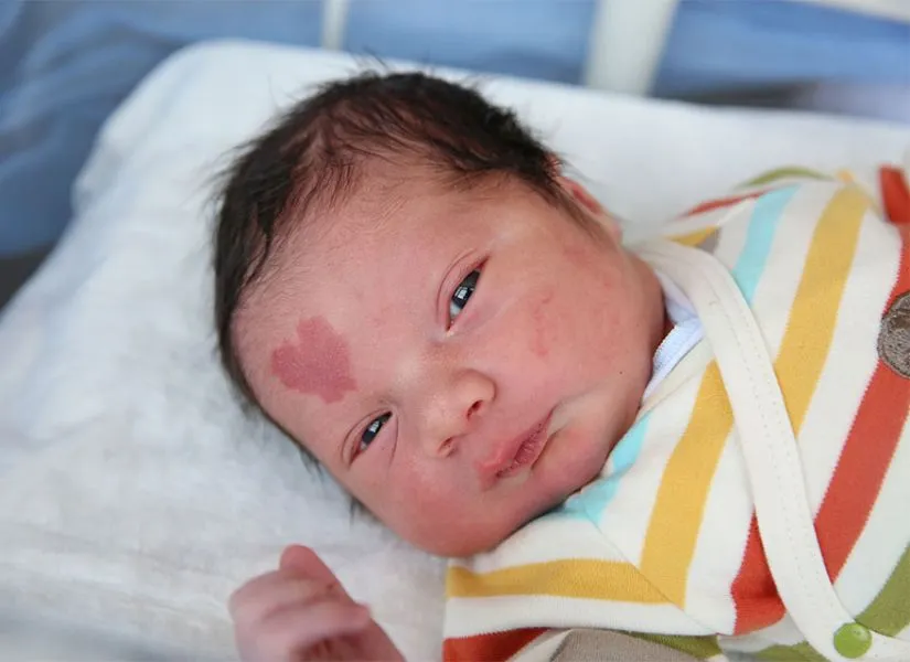 Αυτό το μωρό έγινε viral χάρη στο ιδιαίτερο σημάδι με το οποίο γεννήθηκε!