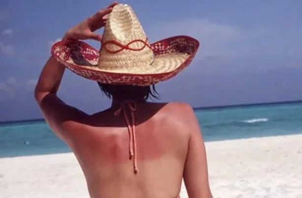 Ήρθε η ώρα να μάθεις τι ακριβώς συμβαίνει στο δέρμα σου όταν καίγεσαι από τον ήλιο
