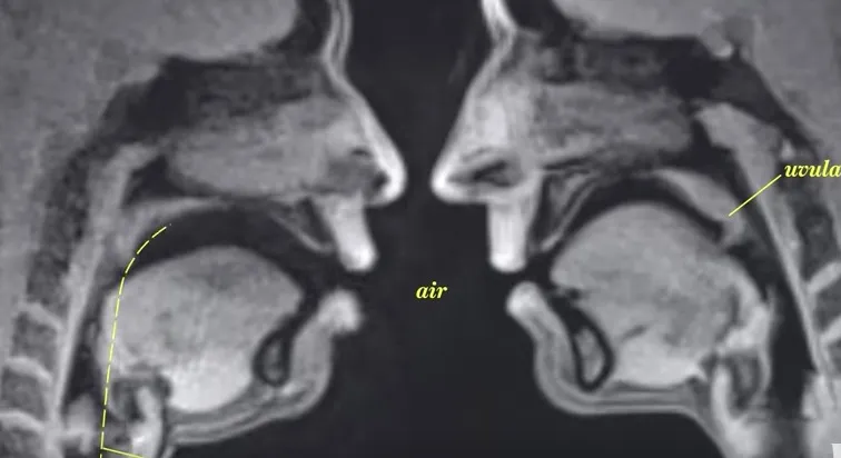 Έτσι φαίνεται το σώμα μας μέσα από μια μαγνητική τομογραφία (video)