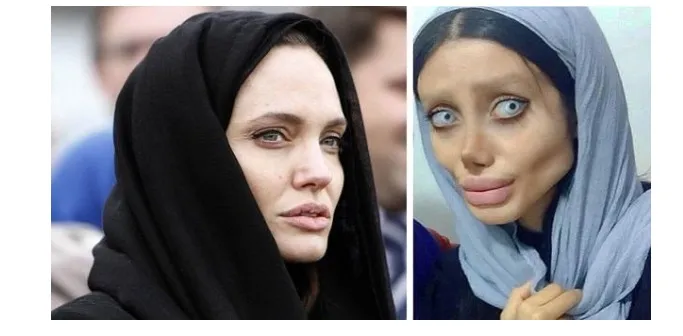 Έκανε 50 πλαστικές για να μοιάζει με την Angelina Jolie είναι ΣΙΓΟΥΡΑ ό,τι πιο άβολο έχεις δει