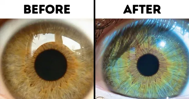 7 πράγματα που μπορούν να αλλάξουν το χρώμα των ματιών μας