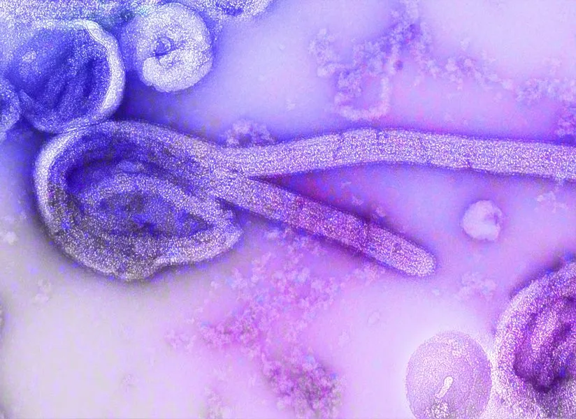 Έμπολα: 2 νέα επιβεβαιωμένα κρούσματα του ιού στο Κονγκό