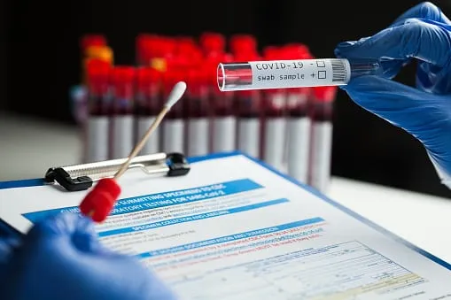 Κορωνοϊός: Νέο μοριακό τεστ εντοπίζει όλες τις παραλλαγές