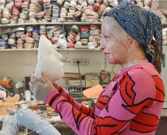 Ιωάννα Παλιοσπύρου: Κύμα συμπαράστασης από τον κόσμο μετά τη φωτογραφία χωρίς μάσκα