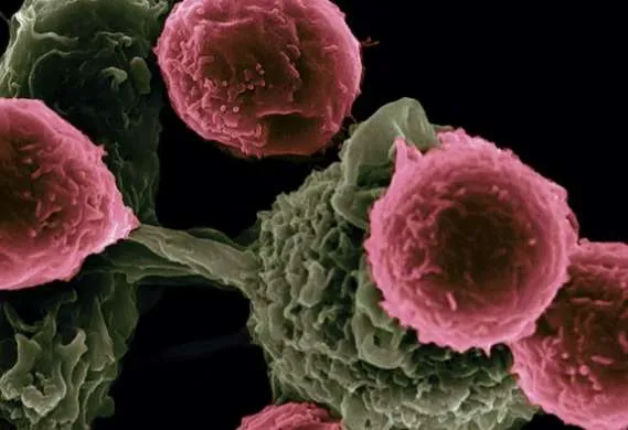 Καρκίνος: Σε δύο χρόνια τα πρώτα εμβόλια mRNA - «Ξεχωριστό για κάθε ασθενή»