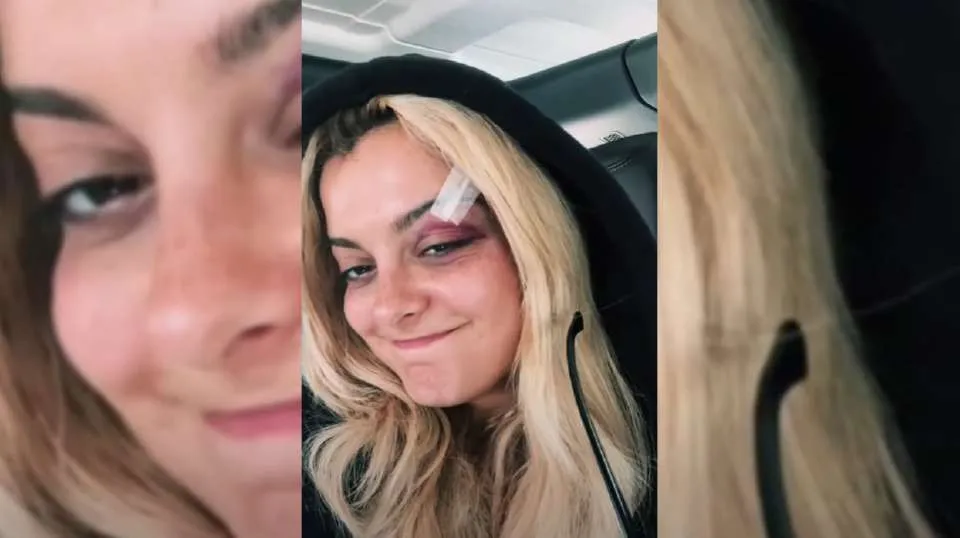 Θαυμαστής πέταξε το κινητό του στο κεφάλι της Bebe Rexha σε συναυλία - Ο τραυματισμός & η αντίδραση της τραγουδίστριας